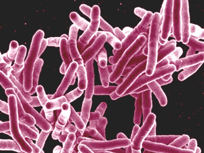 County: Blue Line Trolley Riders Possibly Exposed to Tuberculosis